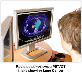 Radiologist reviews a PET/CTimage showing Lung Cancer